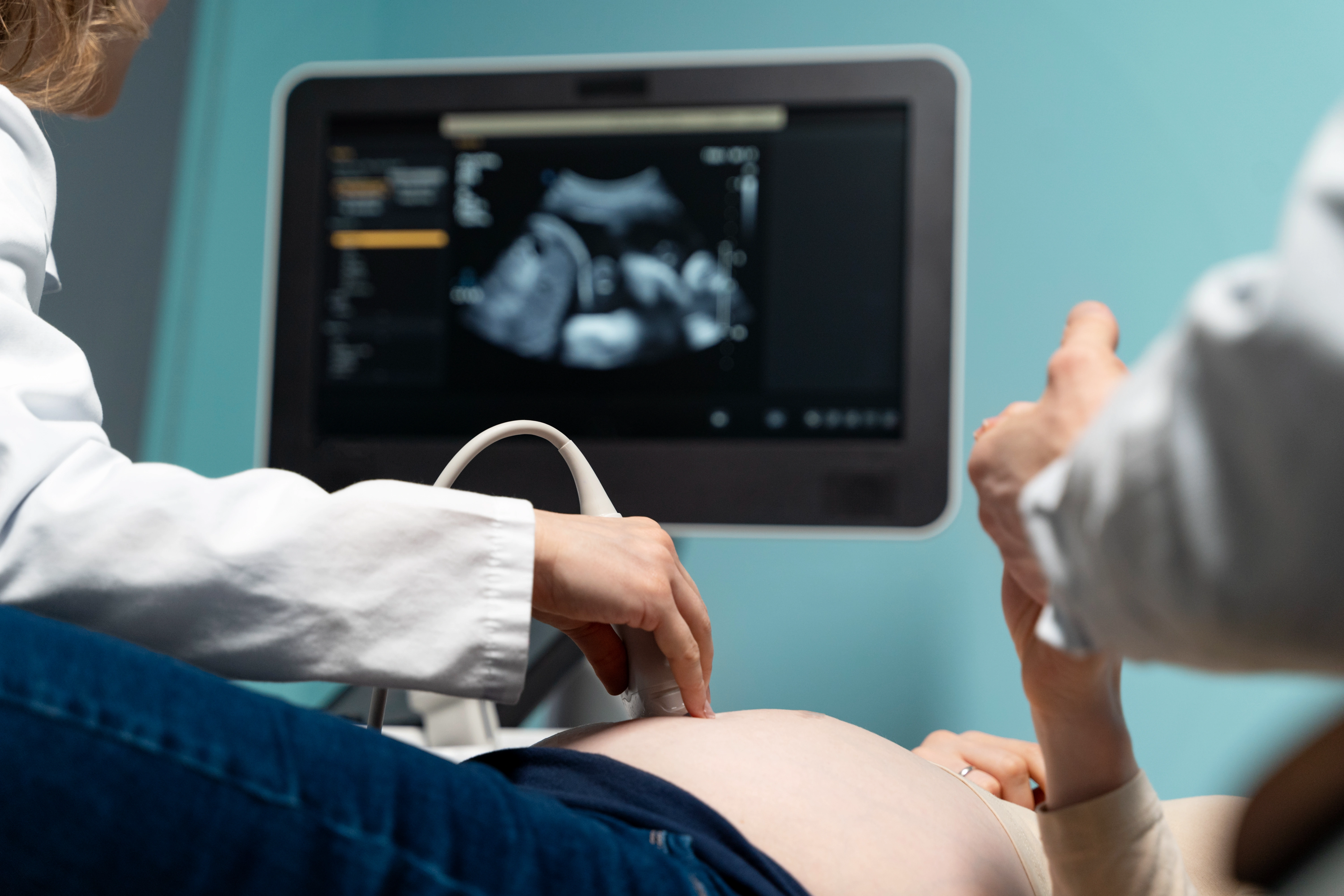 Sonography
